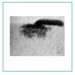 Neutron Imaging